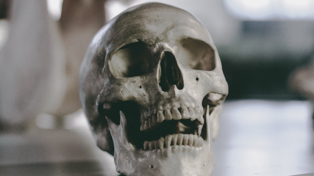 One of the strangest things found in storage units is human bones